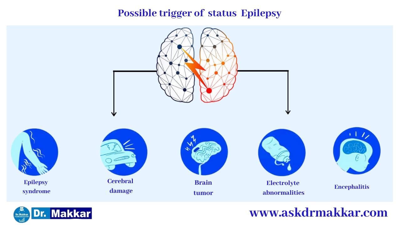 what triggers seizures